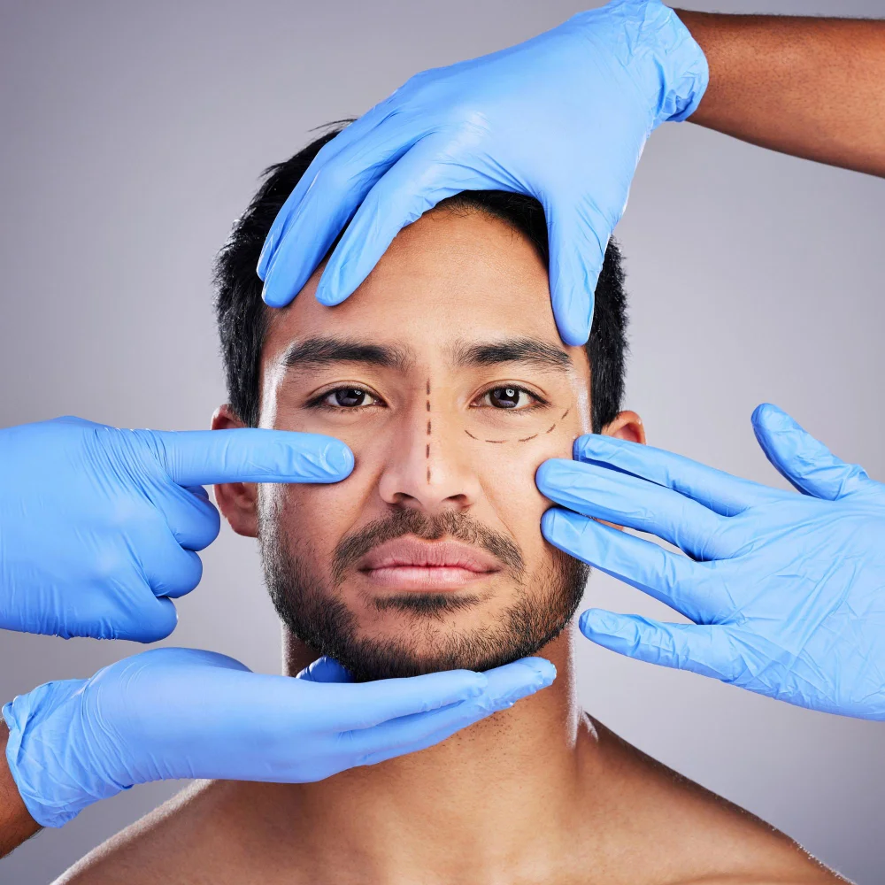 rhinoplasty